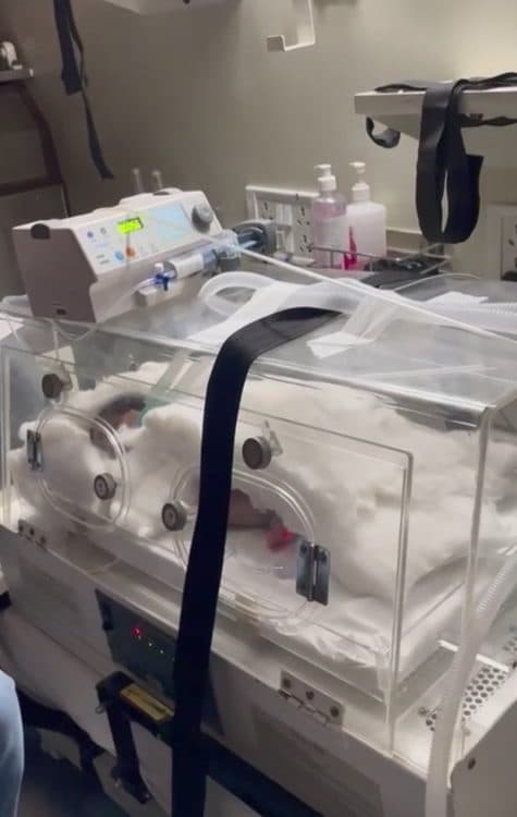 New-Born Baby With ATRIAL SEPTAL DEFECT Shifted From Haryana To BLK HOSPITAL, Delhi