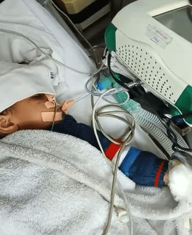 ICU Transportation Of Injured Baby From Gwalior To Delhi